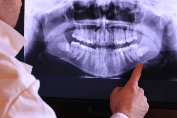 Best Emergency Dentist for Knocked-Out Tooth in Hoisington, KS