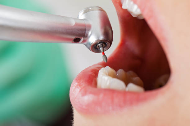 Best Holiday Emergency Dentist in Hoisington, KS